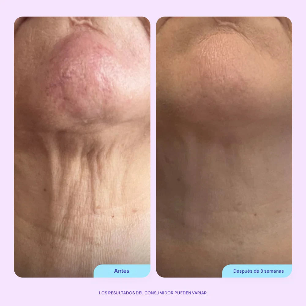 NeckLift crema reafirmante de cuello