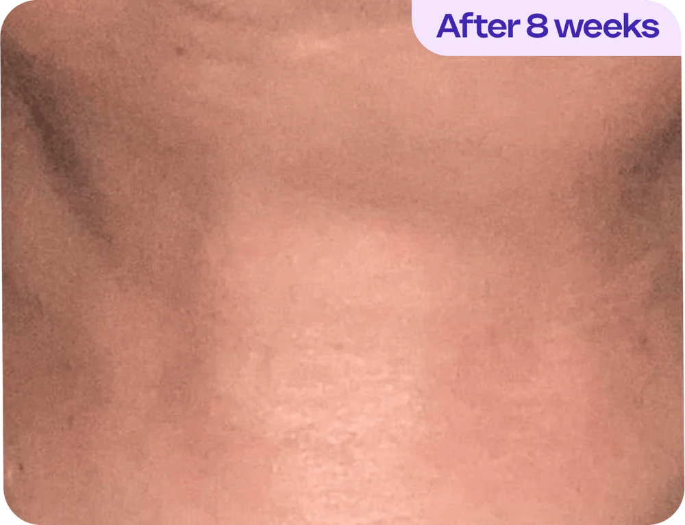 After 8 weeks