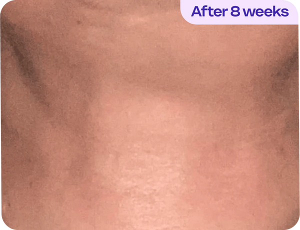After 8 weeks