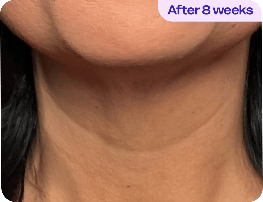 After 8 weeks