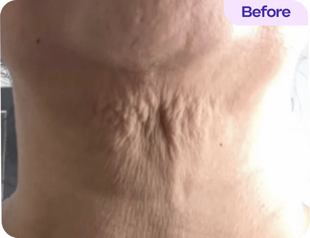 Before treatment