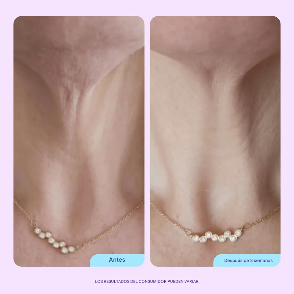NeckLift crema reafirmante de cuello